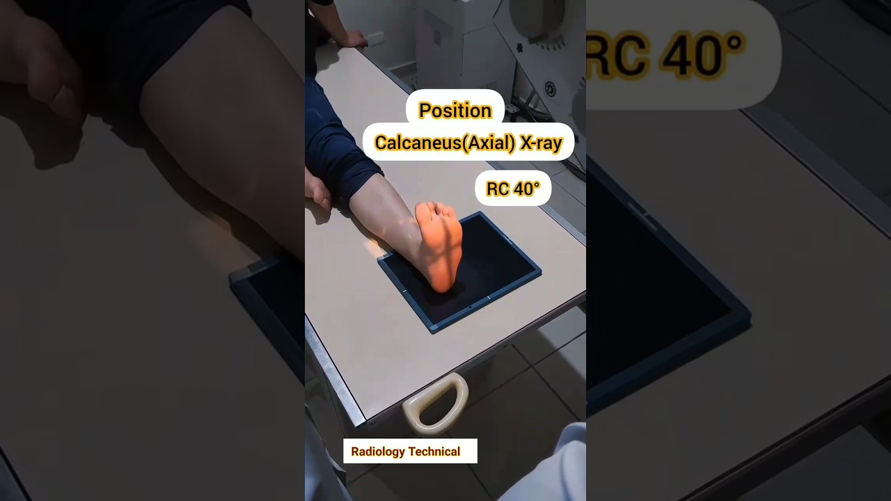 Calcaneus Axial # Lateral view X-ray patient Positioning # Heel axil view #radiography #radiology
