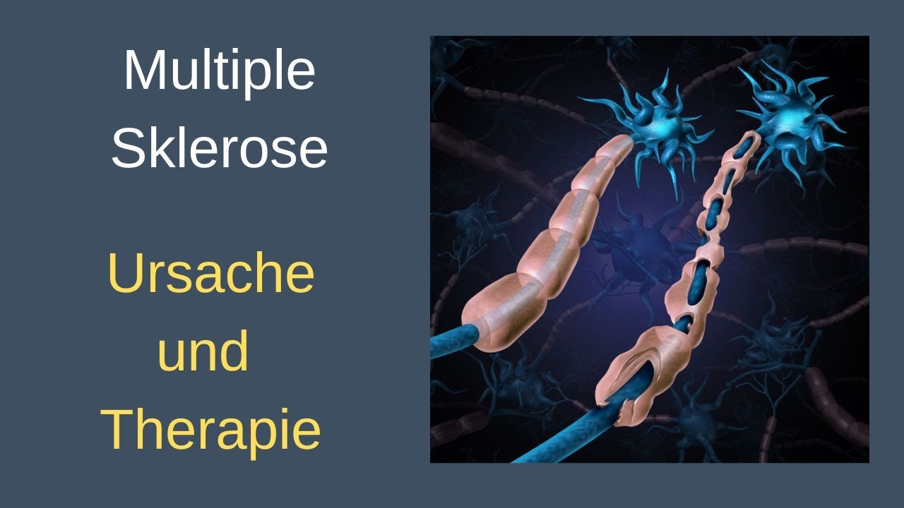 Multiple Sklerose - Ursache und Therapie. QS24 interviert Dr. Volker Schmiedel