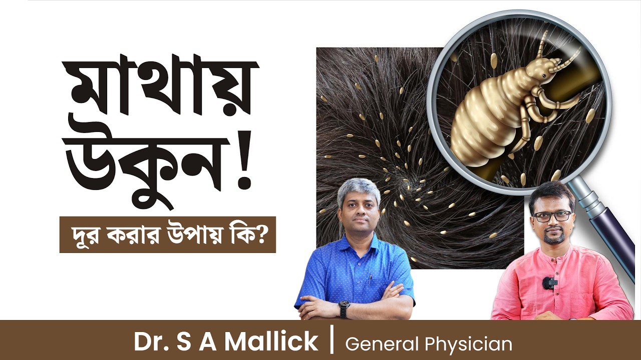 মাথায় উকুন দূর করার উপায় উপায়  | মাথায় উকুন দূর করার ওষুধ | How to Get Rid from Lice and Nits
