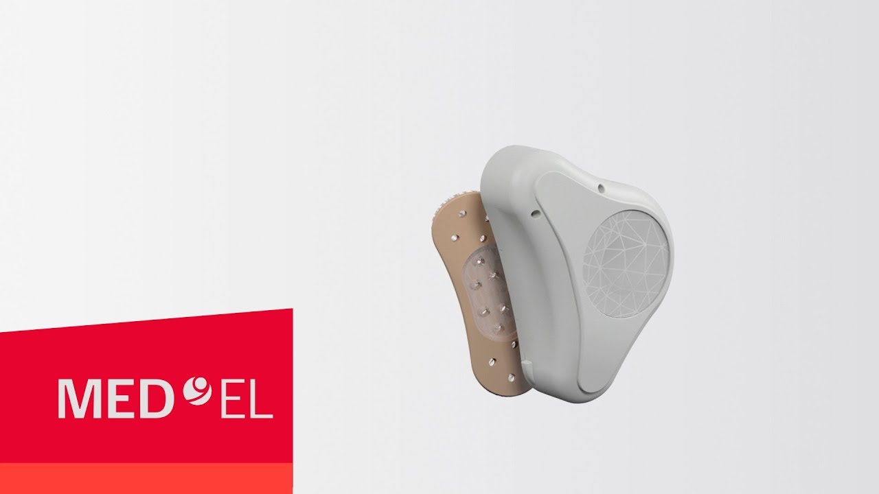 Applying the ADHEAR System | MED-EL