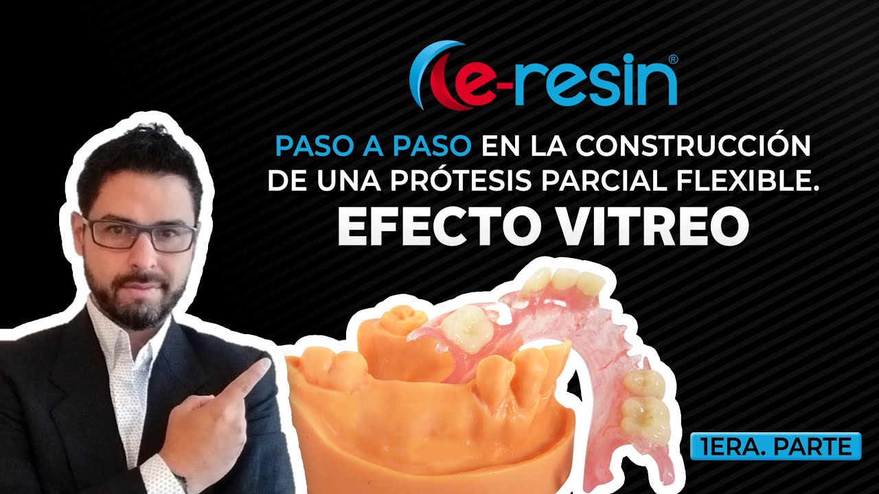 PASO A PASO EN LA CONSTRUCCIÓN DE UNA PRÓTESIS PARCIAL FLEXIBLE. EFECTO VITREO, 1ERA. PARTE.