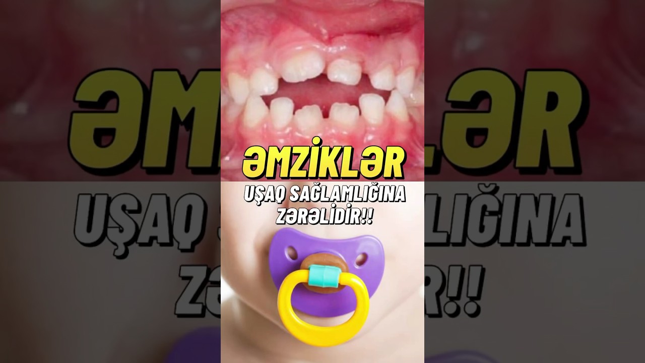 Əmziklər (soska) uşaq sağlamlığına zərərdir!!?  #uşaqstomatoloqu #stomatoloq