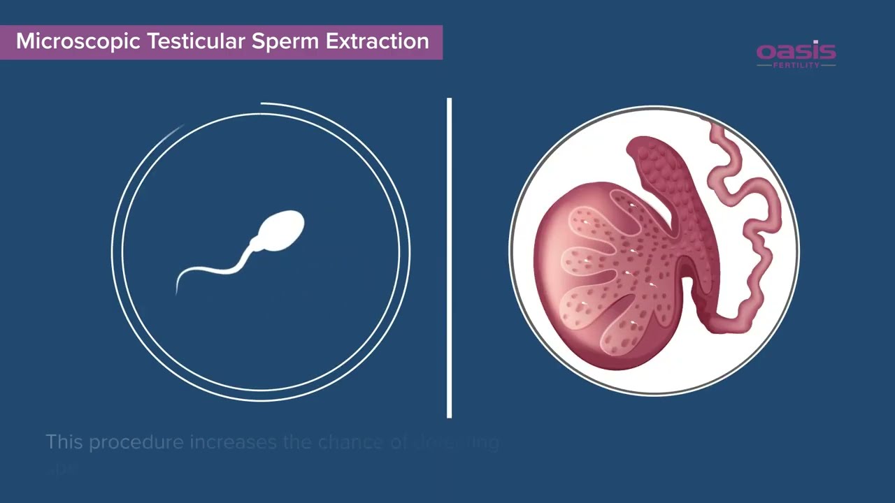 MicroTESE || Oasis Fertility