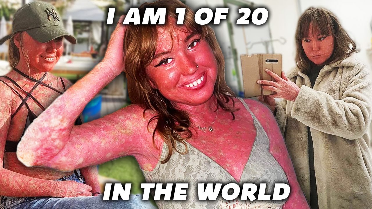 I AM ONE OF 20 IN THE WORLD | NATHALIE RICHERT | SHERA