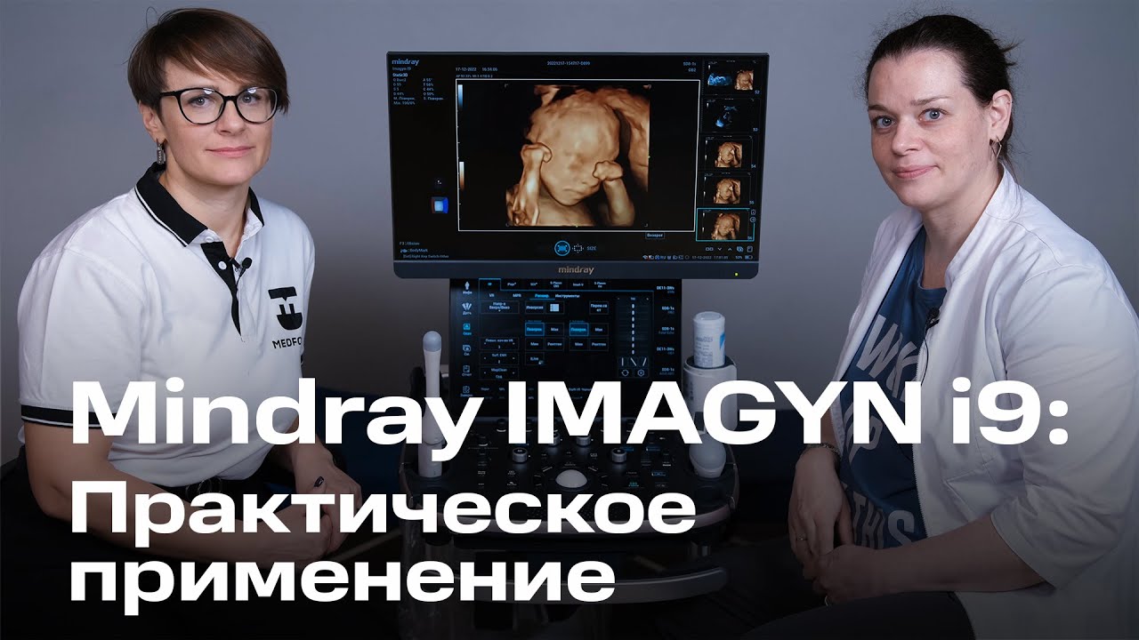 Обзор УЗИ Mindray Imagyn i9 для гинекологии I Практическое применение