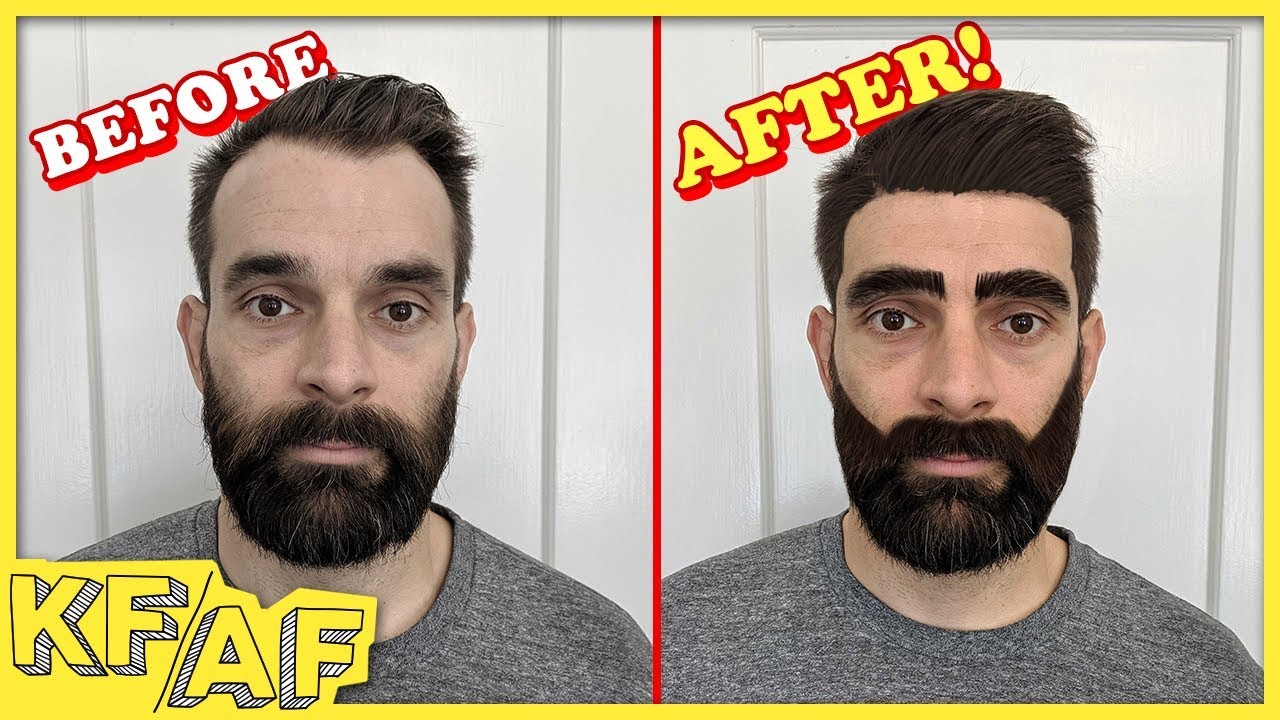 How to Cure Baldness - KF/AF