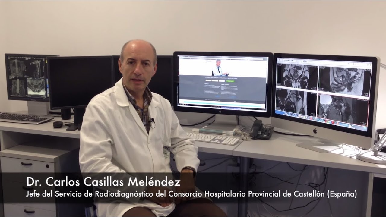 Descubriendo Actualpacs, imagen médica en la nube - Testimonio Hospital Provincial de Castellón