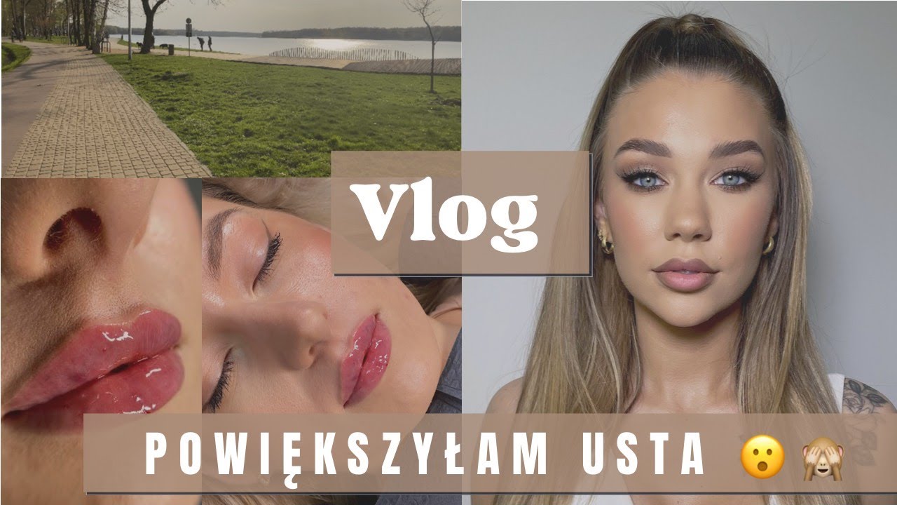VLOG / POWIĘKSZYŁAM USTA 💉- jak to wygląda, co warto wiedzieć / Praca, makijaż