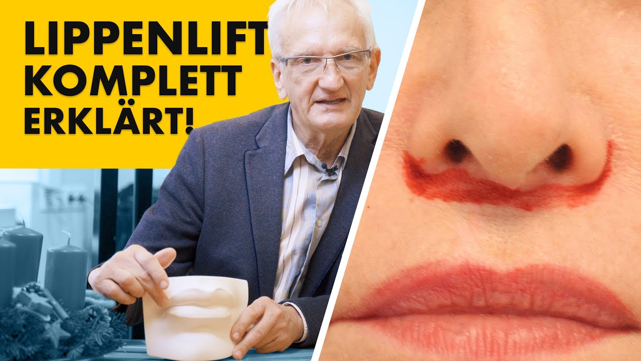 Bullhorn Lift im Detail erklärt! Expertenwissen Liplift | Dr. Jungwirth - Plastische Chirurgie