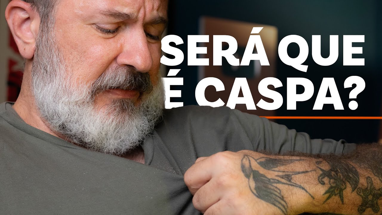 Sua CASPA NA BARBA pode N&Atilde;O SER Caspa na Barba (Descubra)