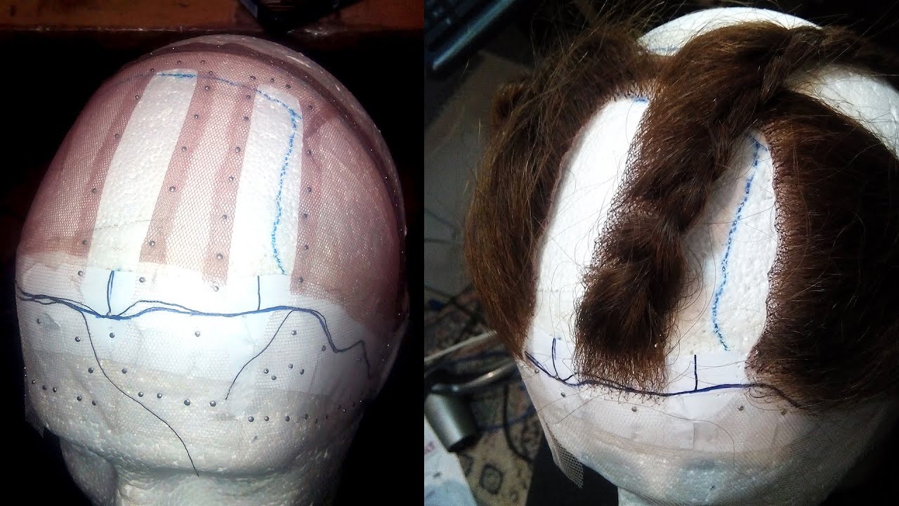 Double U-part frontal