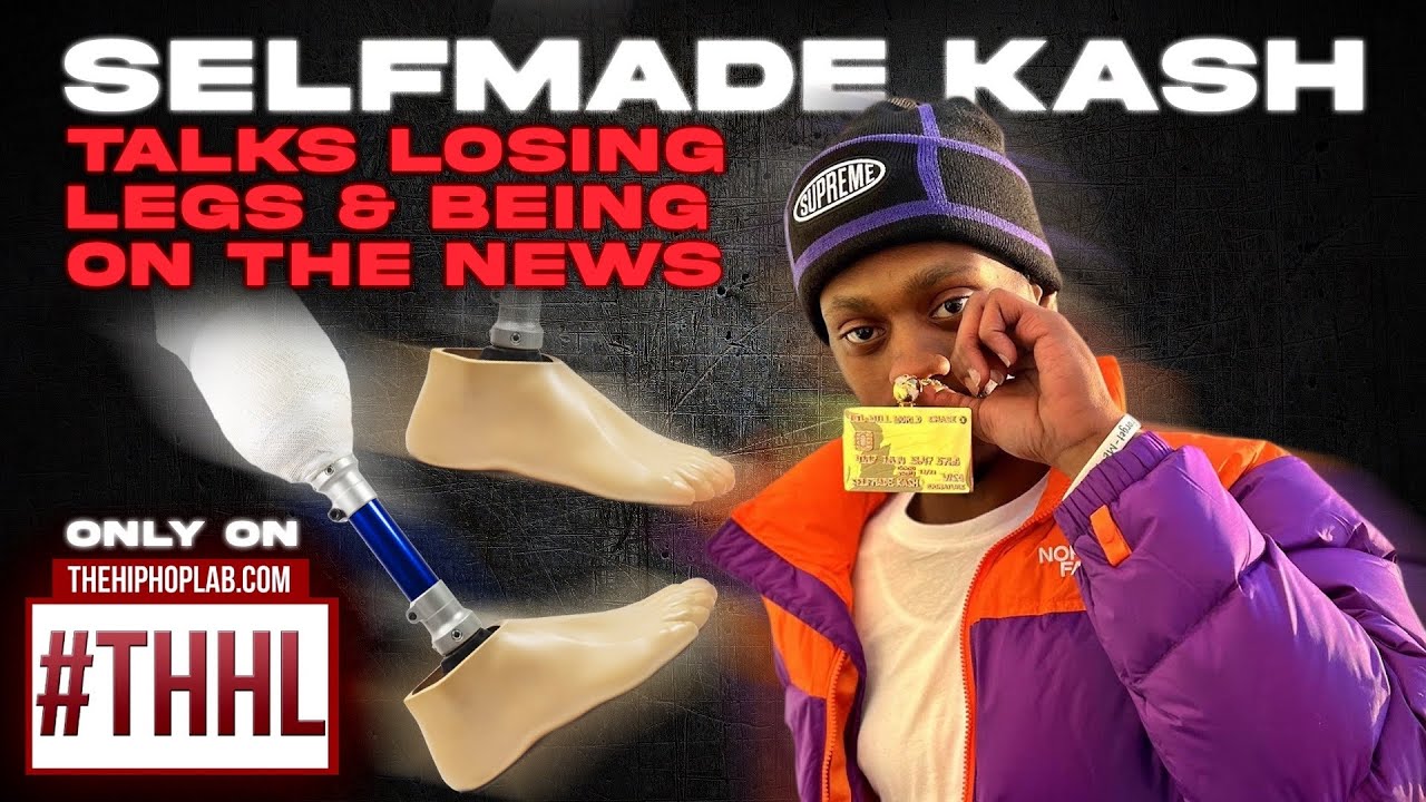 Self Made Kash talks Losing Legs and Being On The News for indictment. (Part 1)
