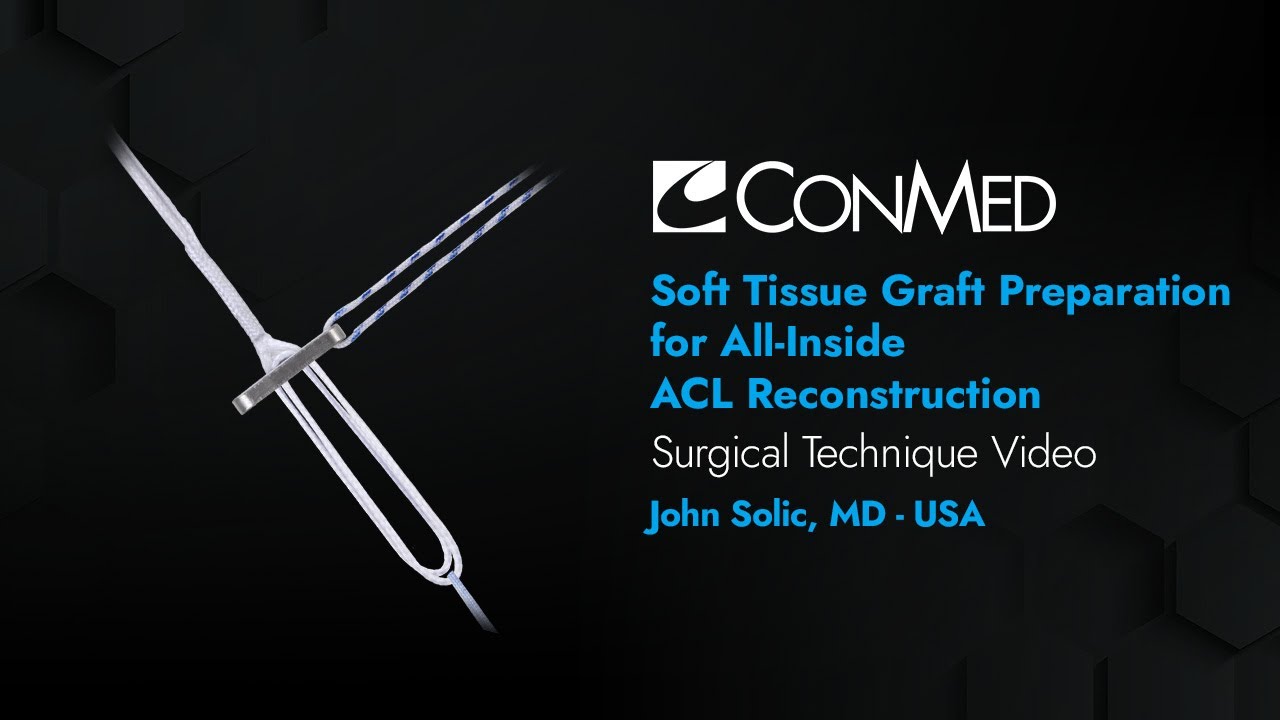 Dr. John Solic - Soft Tissue Graft Preparation for All-Inside ACL Reconstruction - CONMED Technique