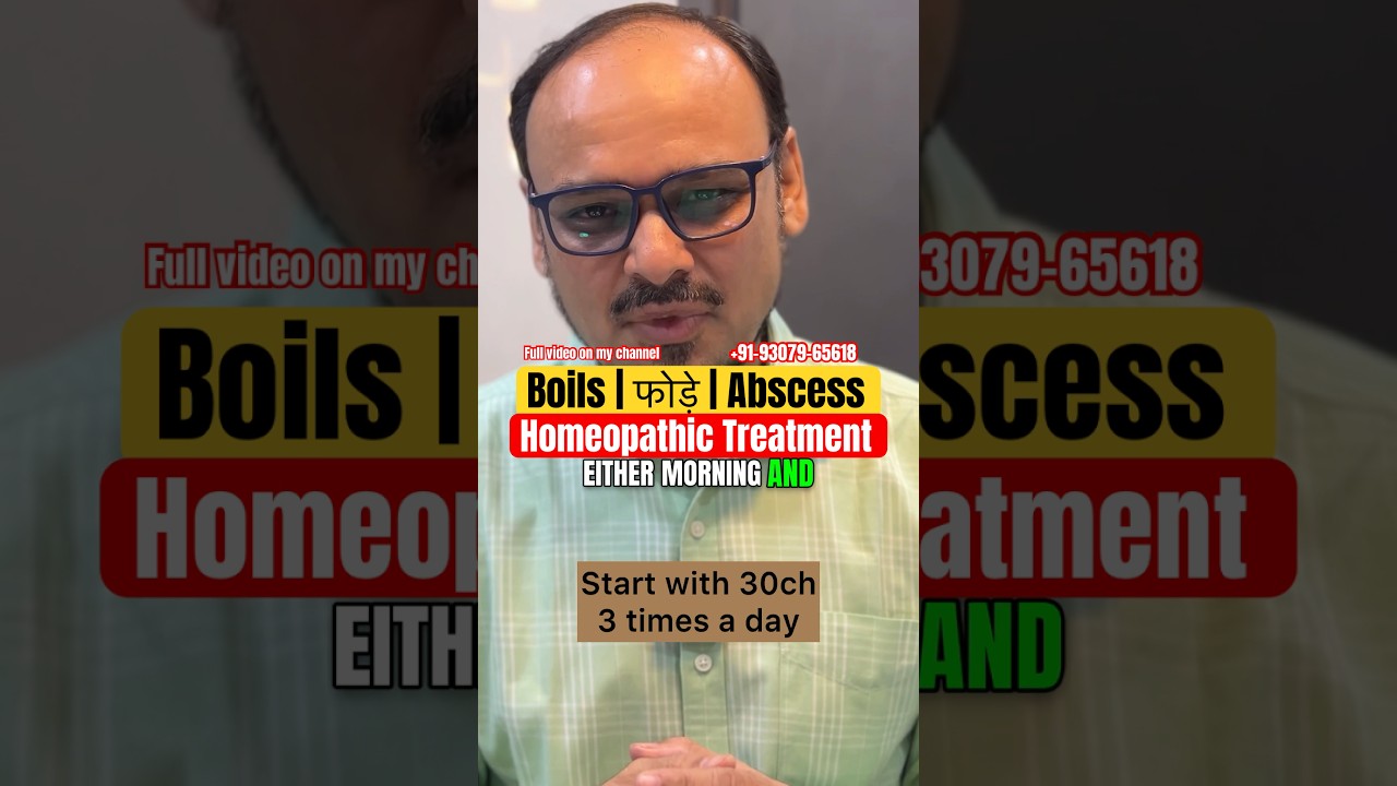 फोड़े | Boils | Abscess | Homeopathic Treatment | Potency Selection | Repetition | Dr Aadil |