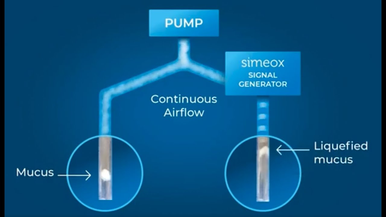 What is the principle of use of the Simeox - PhysioAssist