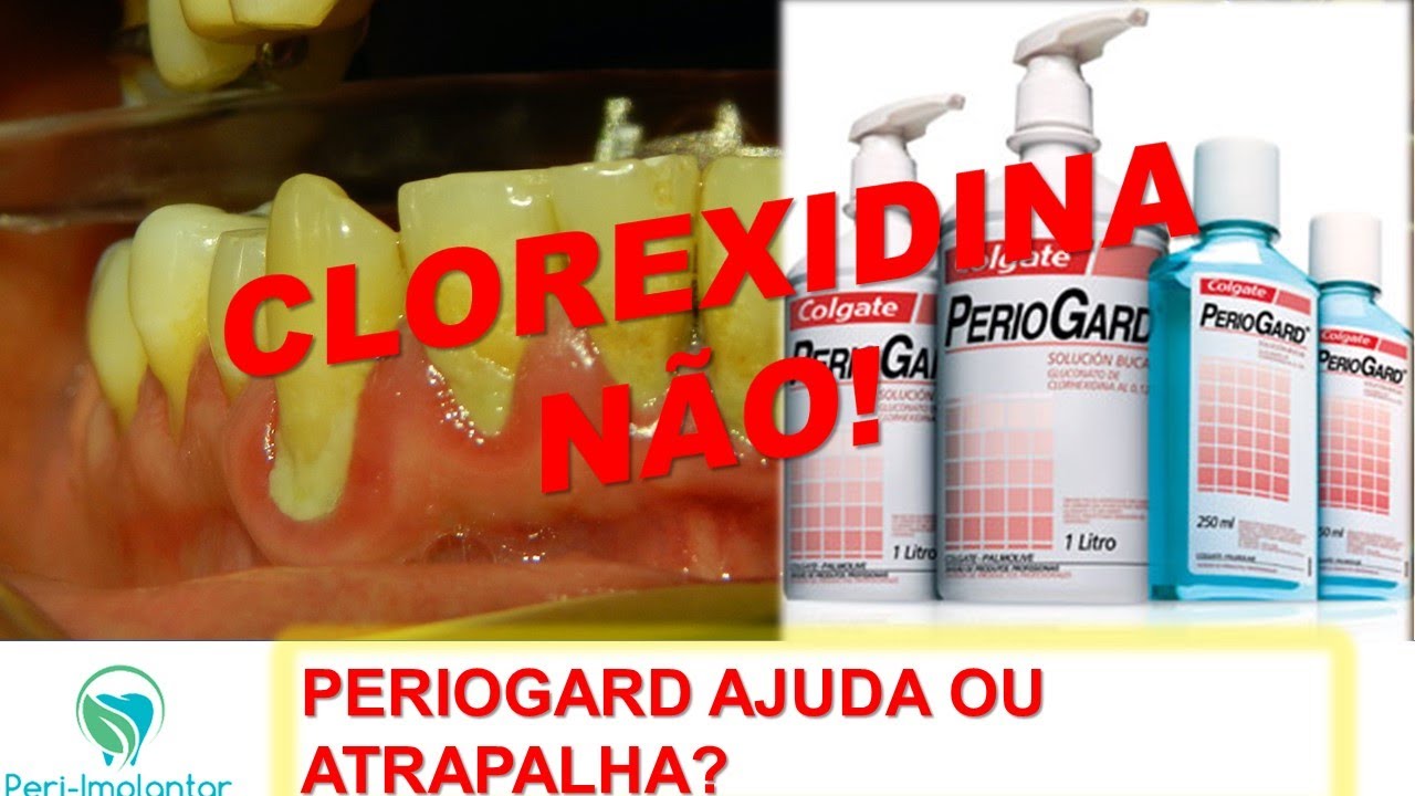 Pare de prescrever clorexidina! (Entenda o porquê...)
