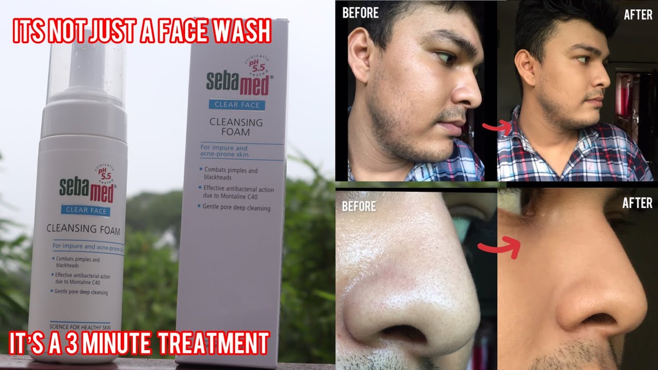 Обзор очищающей пенки для лица Sebamed Clear
