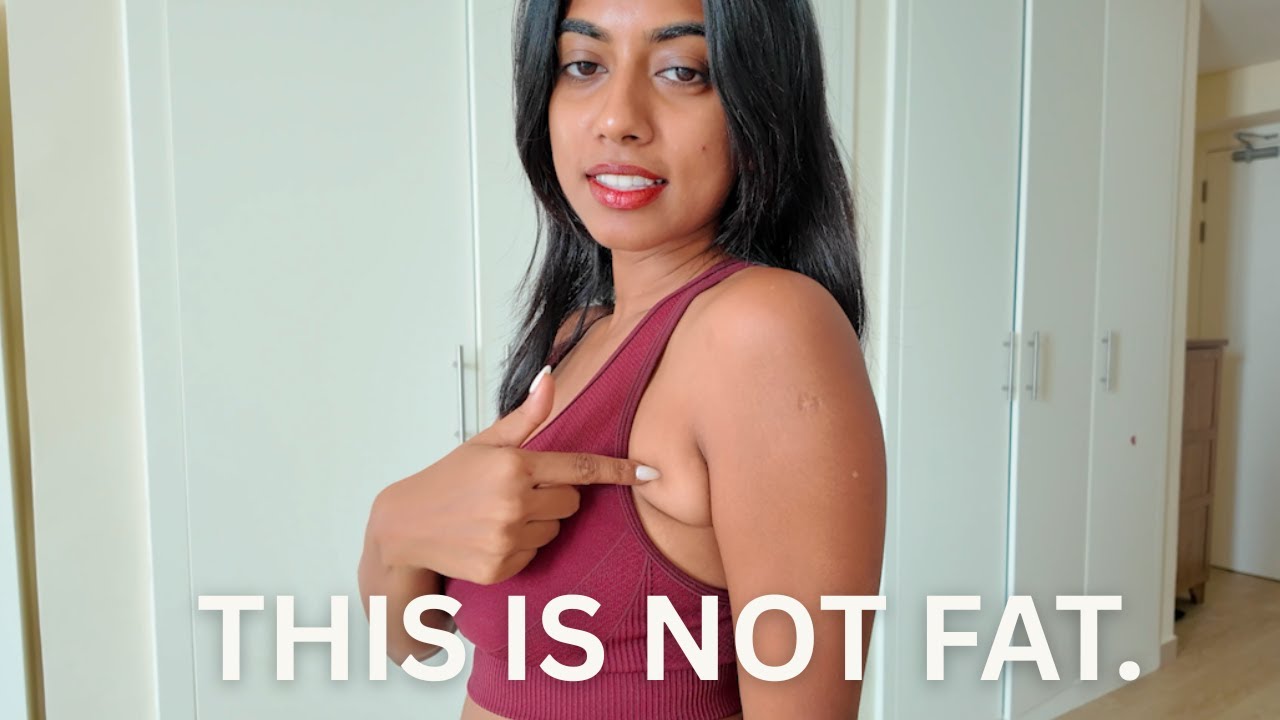 MY AXILLARY BREAST REMOVAL EXPERIENCE: 1 WEEK LATER (ARMPIT FAT REMOVAL) 💉🩹