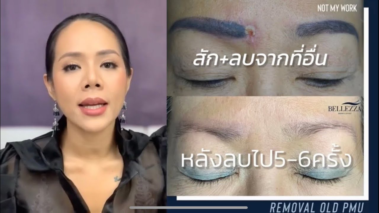 แก้คิ้ว อยากลบคิ้วที่สัก ทำยังไงได้บ้าง?