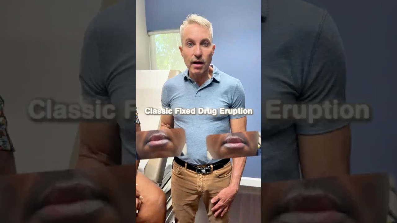 Объяснение фиксированной лекарственной сыпи | Дерматологическая клиника доктора Тори Салливана