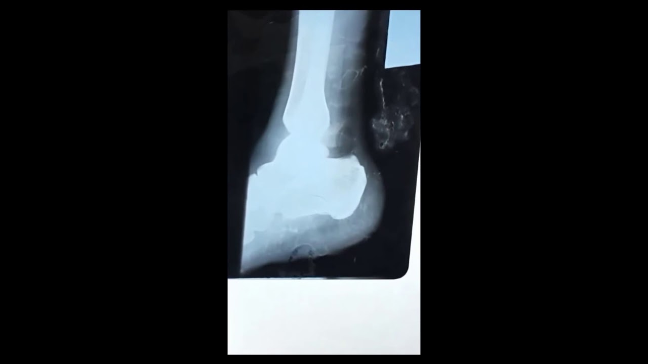 Practical Forensic  X ray   Part 3