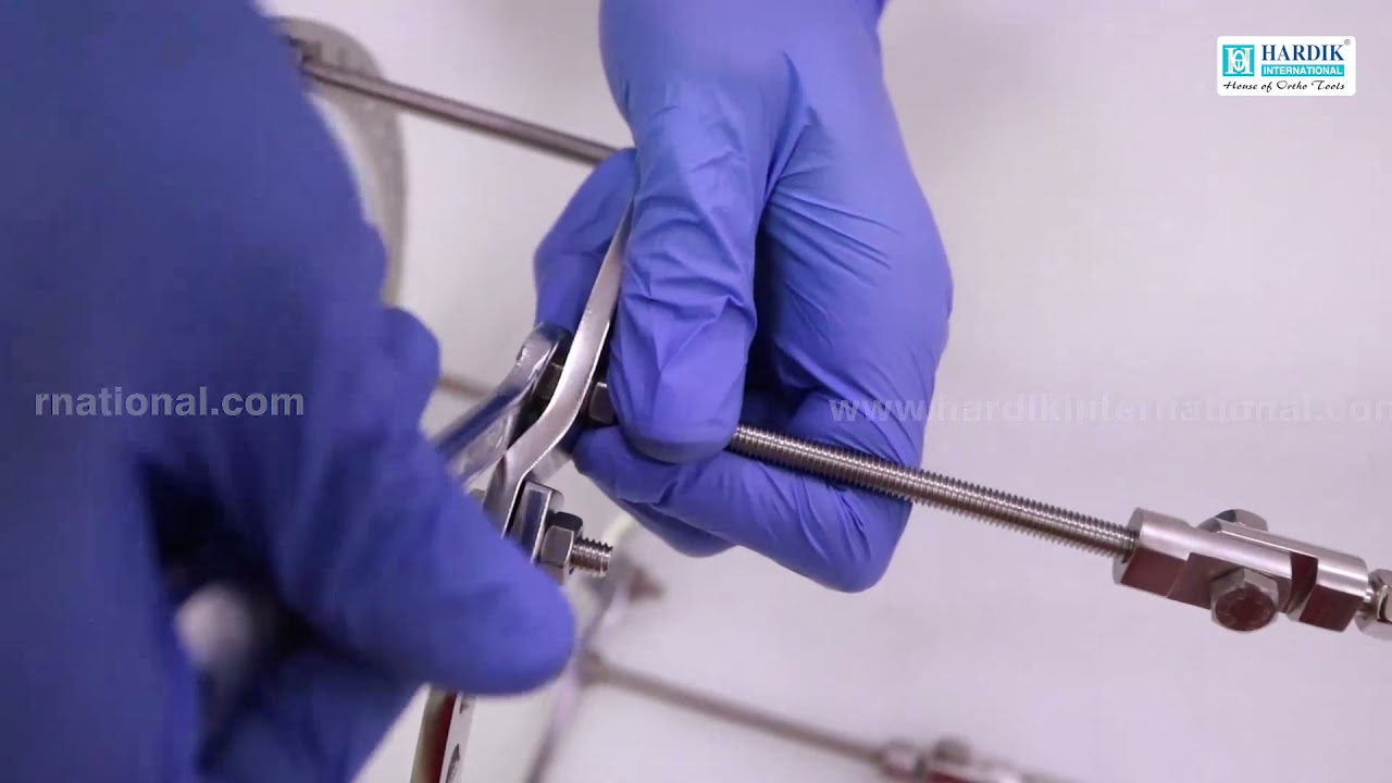 External Ring Fixator