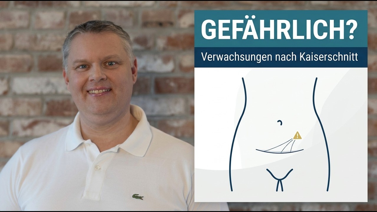 Sind Verwachsungen nach einem Kaiserschnitt gefährlich?