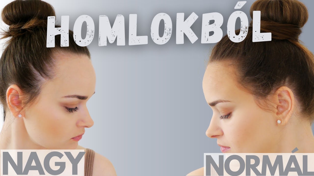 Sminktr&uuml;kk&ouml;k bevet&eacute;se nagy homlok ellen