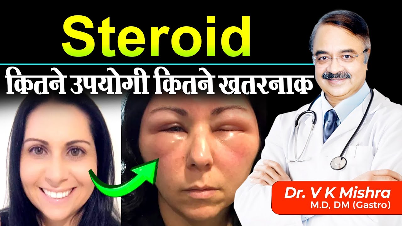 Steroid कितने उपयोगी कितने खतरनाक || CORTICOSTEROIDS AND ANABOLIC STEROIDS WHAT ARE THEY