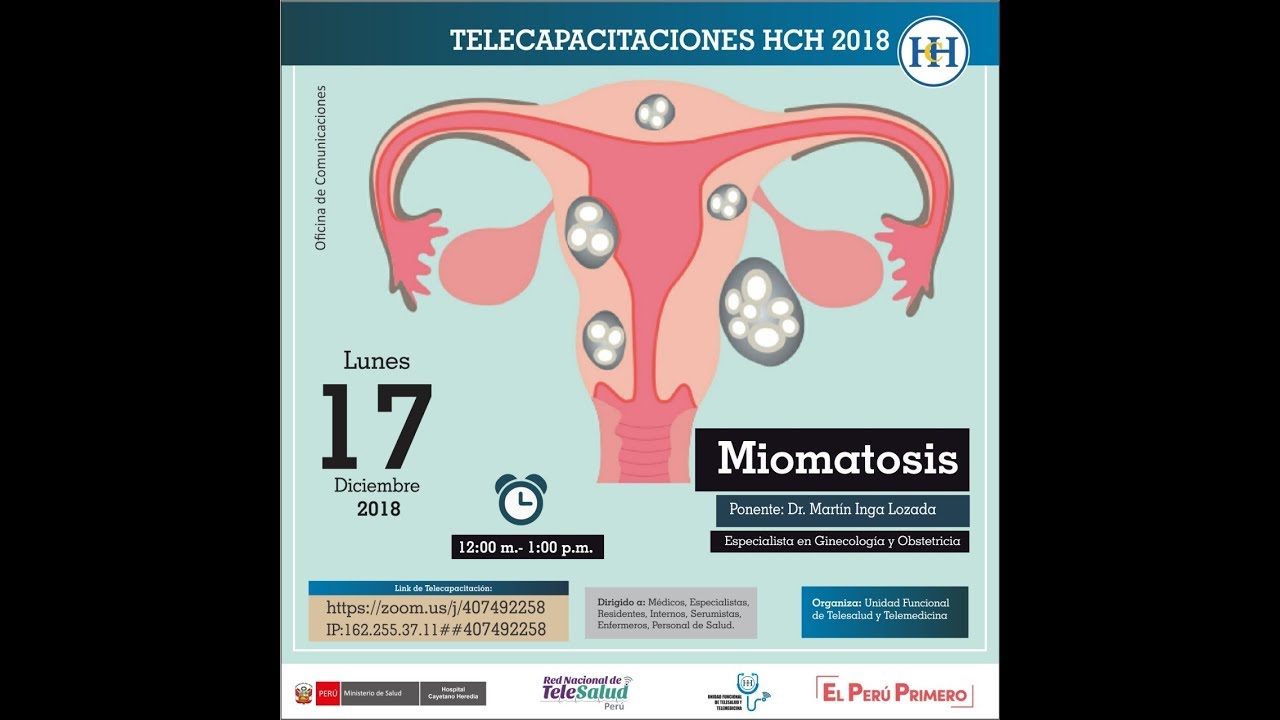 MIOMATOSIS UTERINA