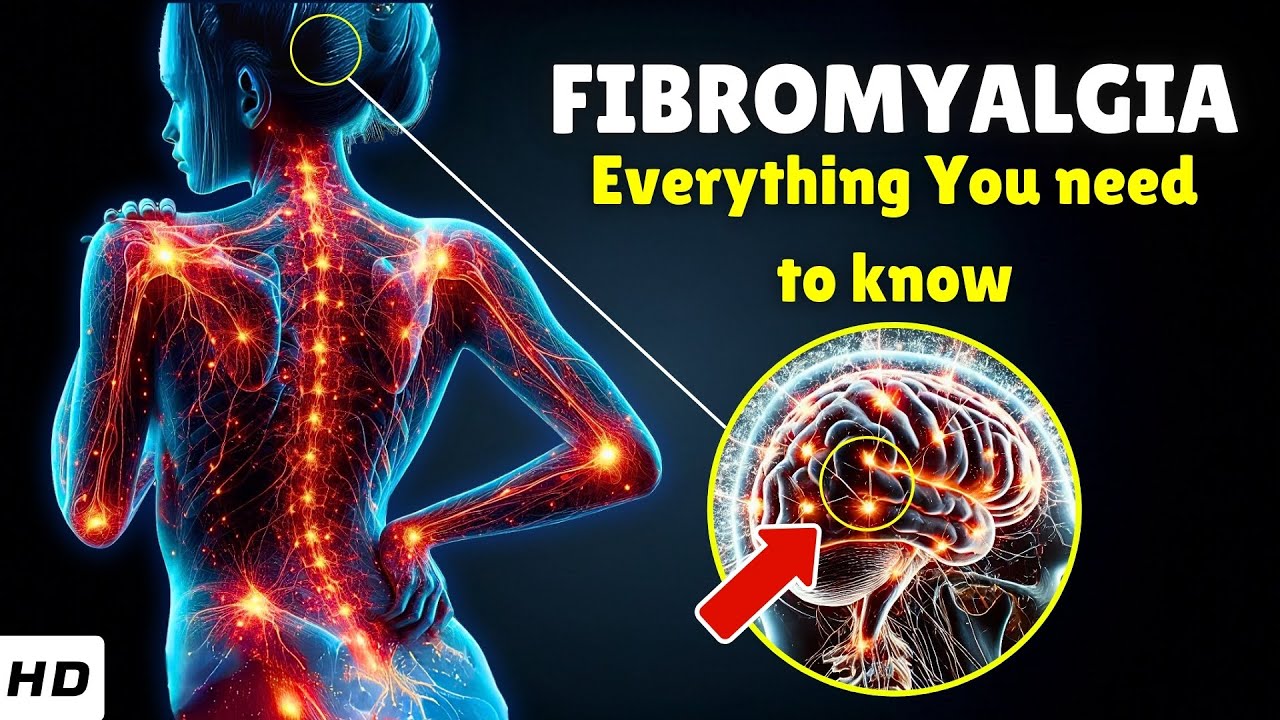Fibromyalgia Explained: Causes, Signs and Symptoms, Diagnosis & Treatment Options