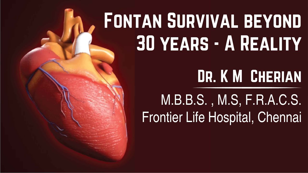 Fontan Survival beyond 30 years - A Reality