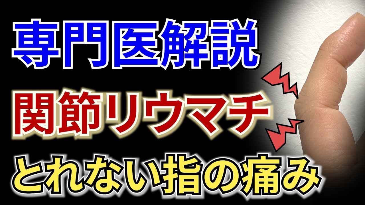 【専門医解説】関節リウマチ -指の関節の痛み-
