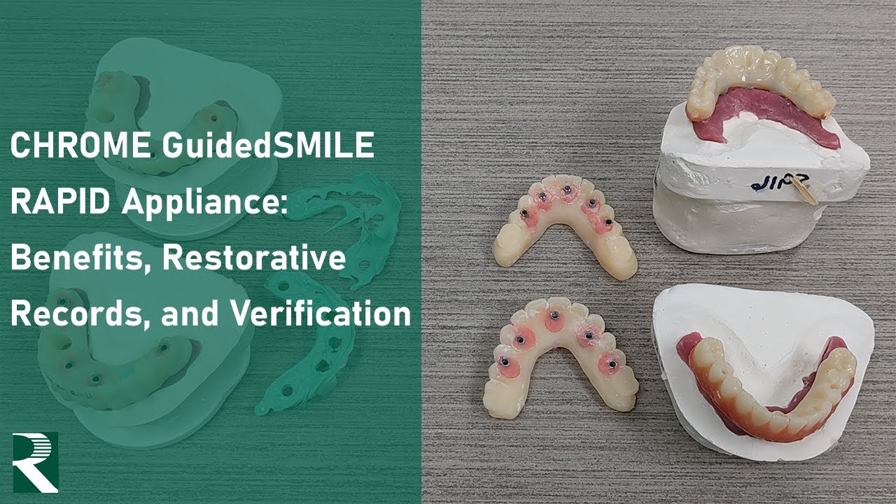 CHROME GuidedSMILE RAPID Appliance: Basics, Restorative Records, and Verification