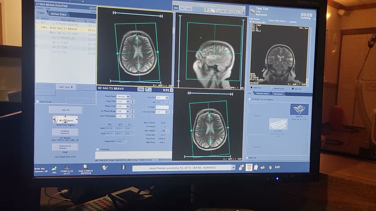 Brain MRI on the Signa Voyager