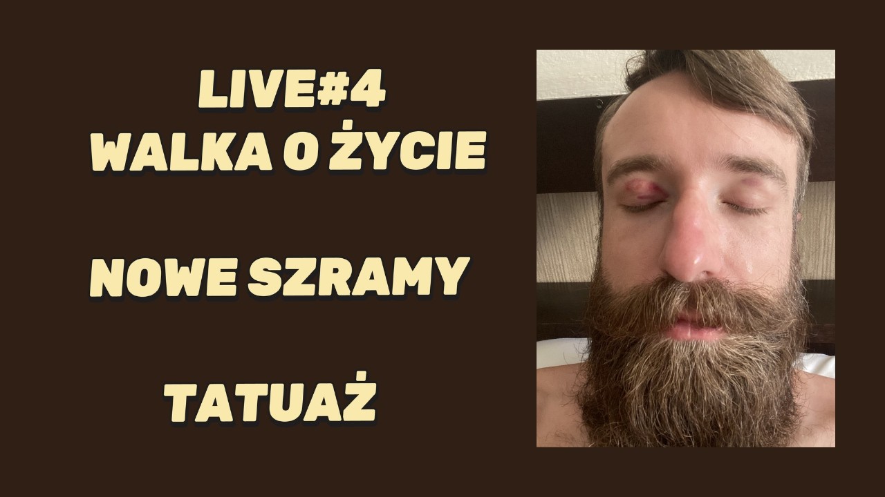 LIVE#4 - WALKA O ŻYCIE, NOWE SZRAMY, TATUAŻ ZROBIONY PRZEZ MNICHA