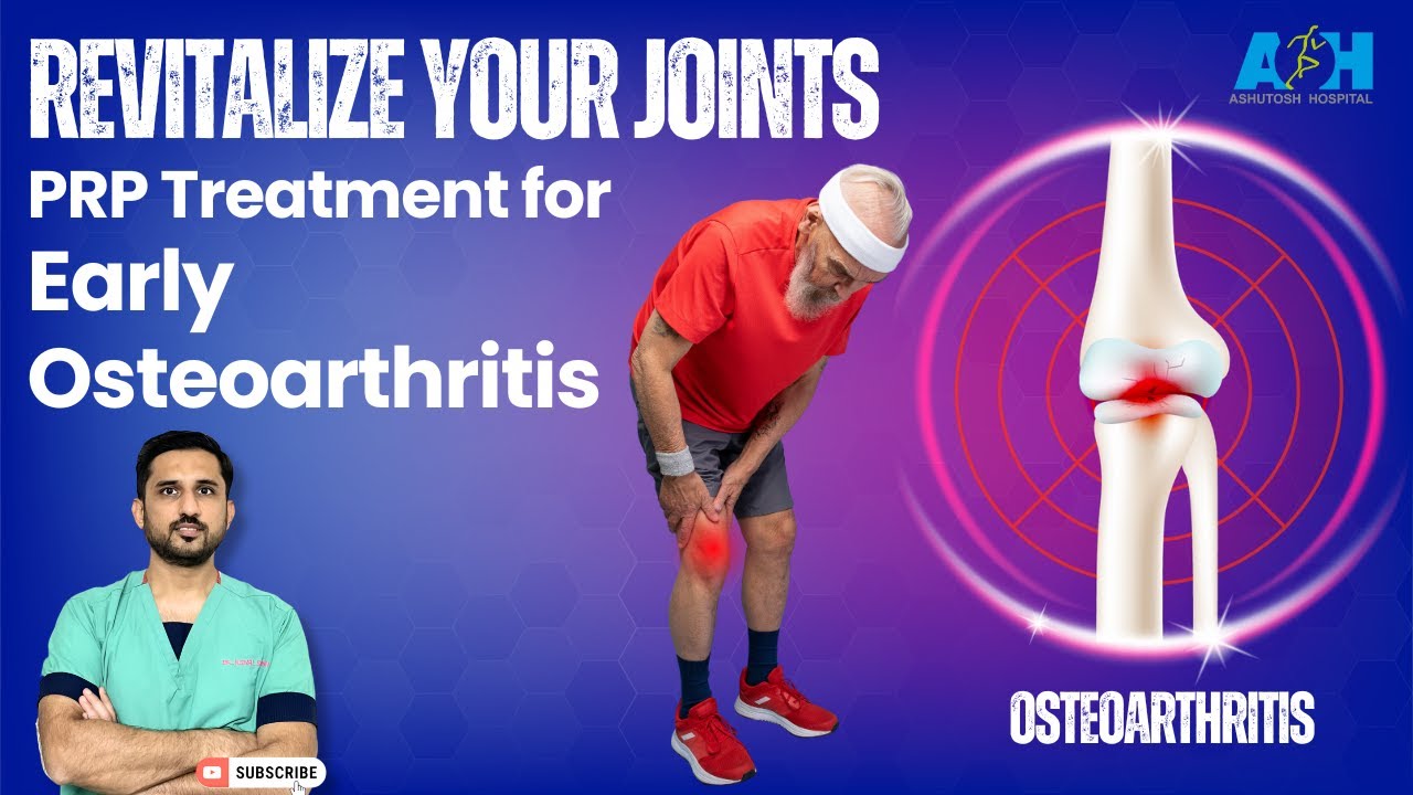 PRP (Platetelet Rich Plasma) Treatment to cure early stage Osteoarthritis