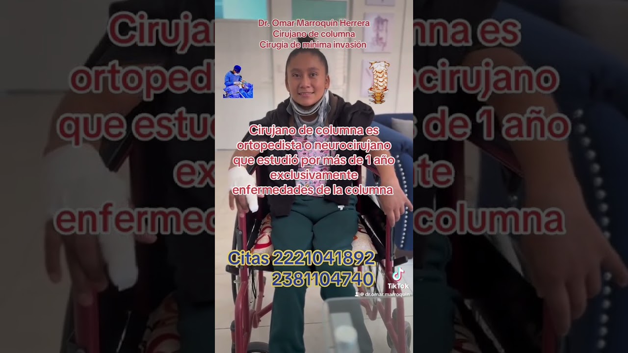 Dr. Omar Marroqu&iacute;n Herrera fractura cervical cuadriplejia que revierte #fracturas #cervical