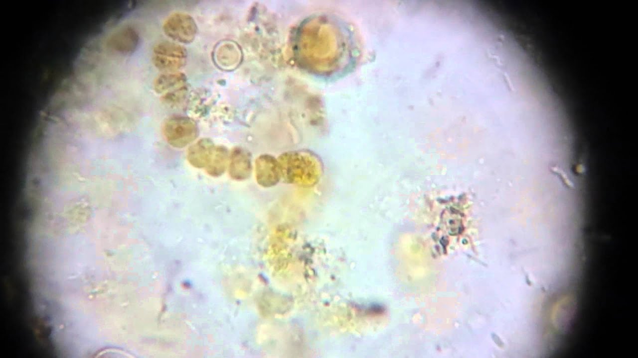 Spirochaetes