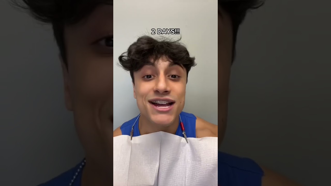 Getting My Braces OFF