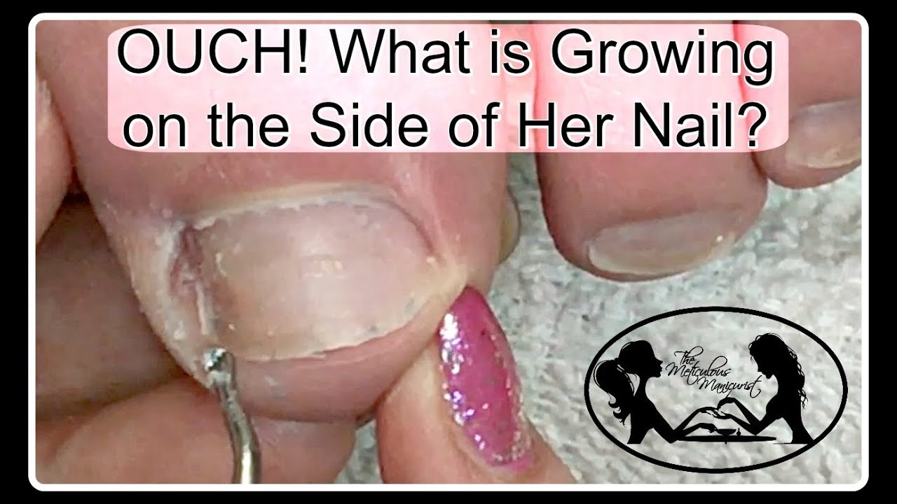 Pedicure Tutorial: What Mimics Ingrown Toenail Pain Pro Tools Available on My Online Store ✔️