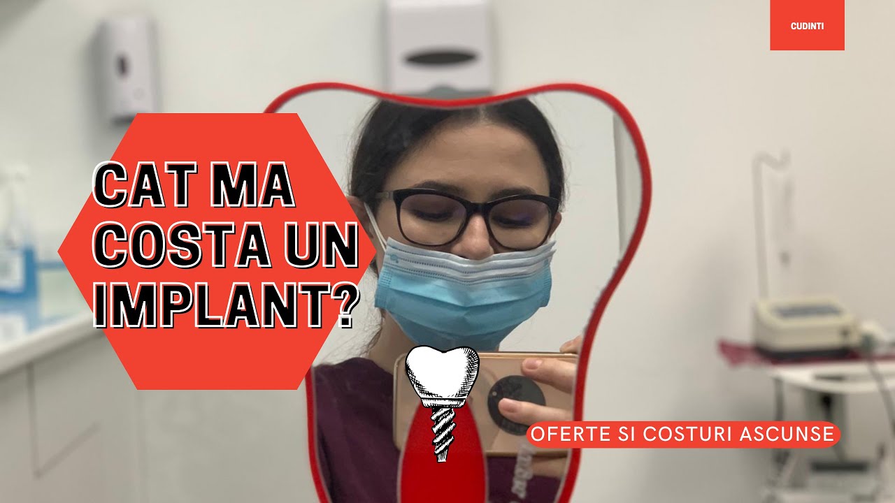 CAT COSTA UN IMPLANT DENTAR | cuDinti
