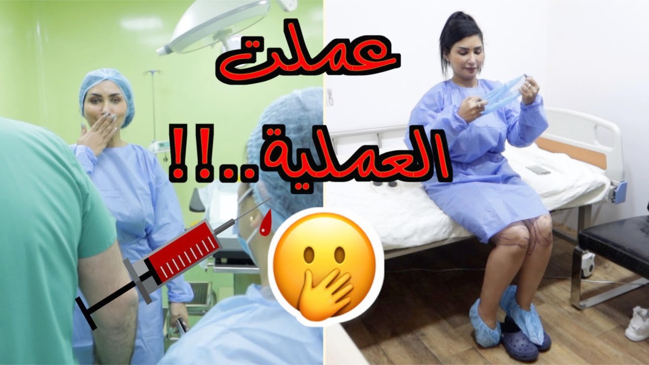 عملت عملية تجميل  شفط و حقن دهون و طلعت بنفس اليوم 🤩