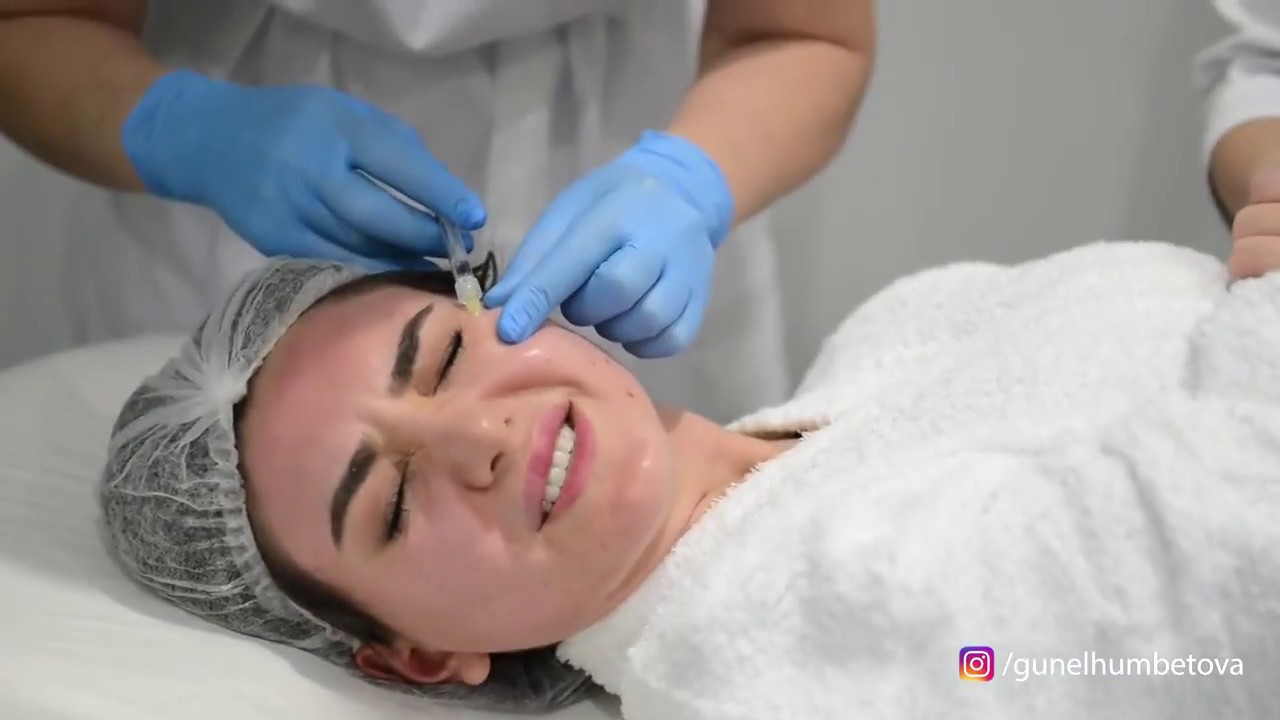 Biorevitalizasiya