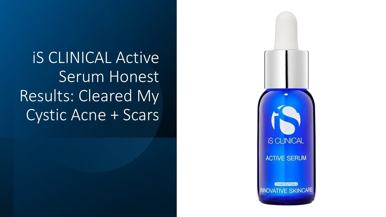 iS CLINICAL Active Serum Honest Results: Cleared My Cystic Acne + Scars
