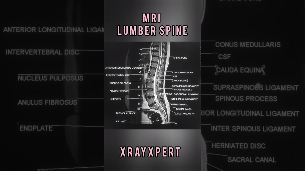 Lumbar Spine MRI (Sagittal View) with Detailed Labeling.#XrayXpert #MRI #SpineAnatomy #Radiology