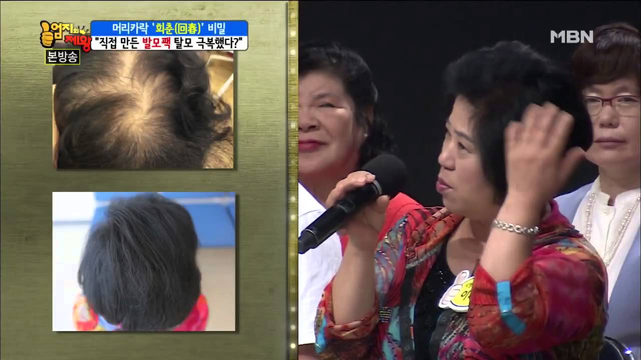 발모팩으로 3달 만에 탈모가 개선됐다?