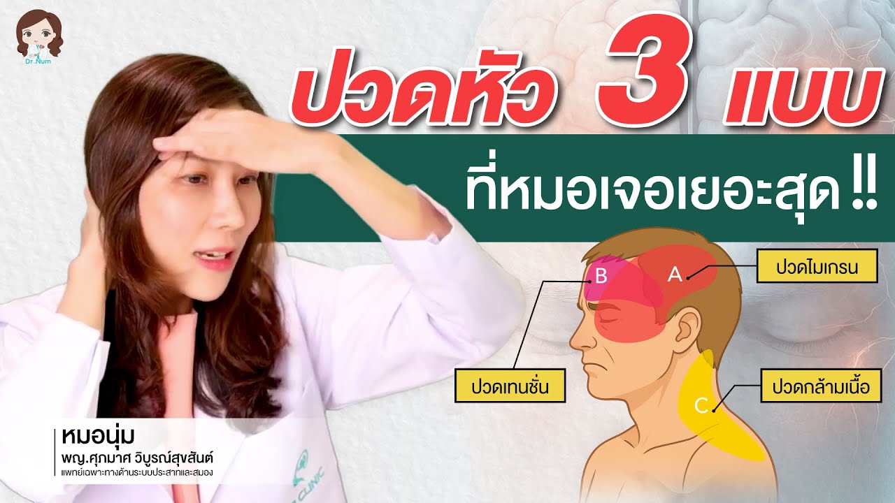 ปวดหัวไม่หาย ? 3 โรคปวดหัวที่หมอเจอบ่อยที่สุด ไมเกรน เทนชั่น กล้ามเนื้อ