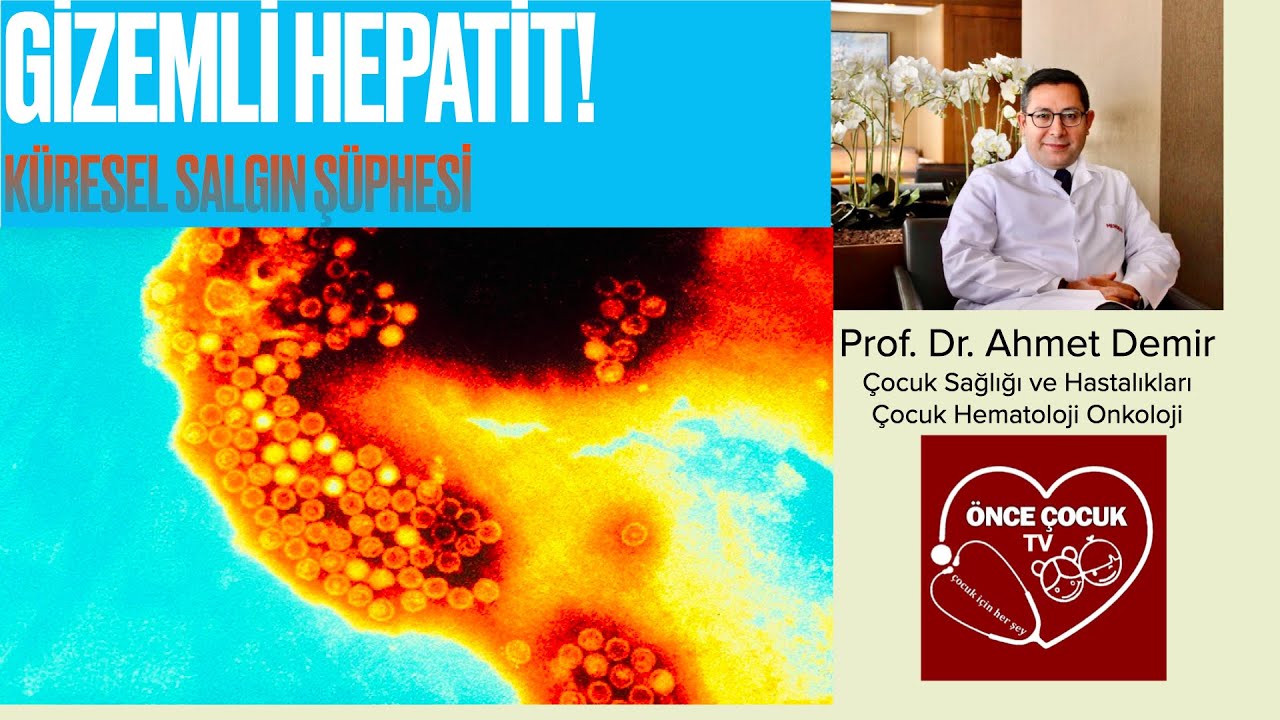 Çocuklarda Gizemli Hepatit (Nedeni Bilinmeyen), Gizli Hepatit, Prof Dr Ahmet Demir