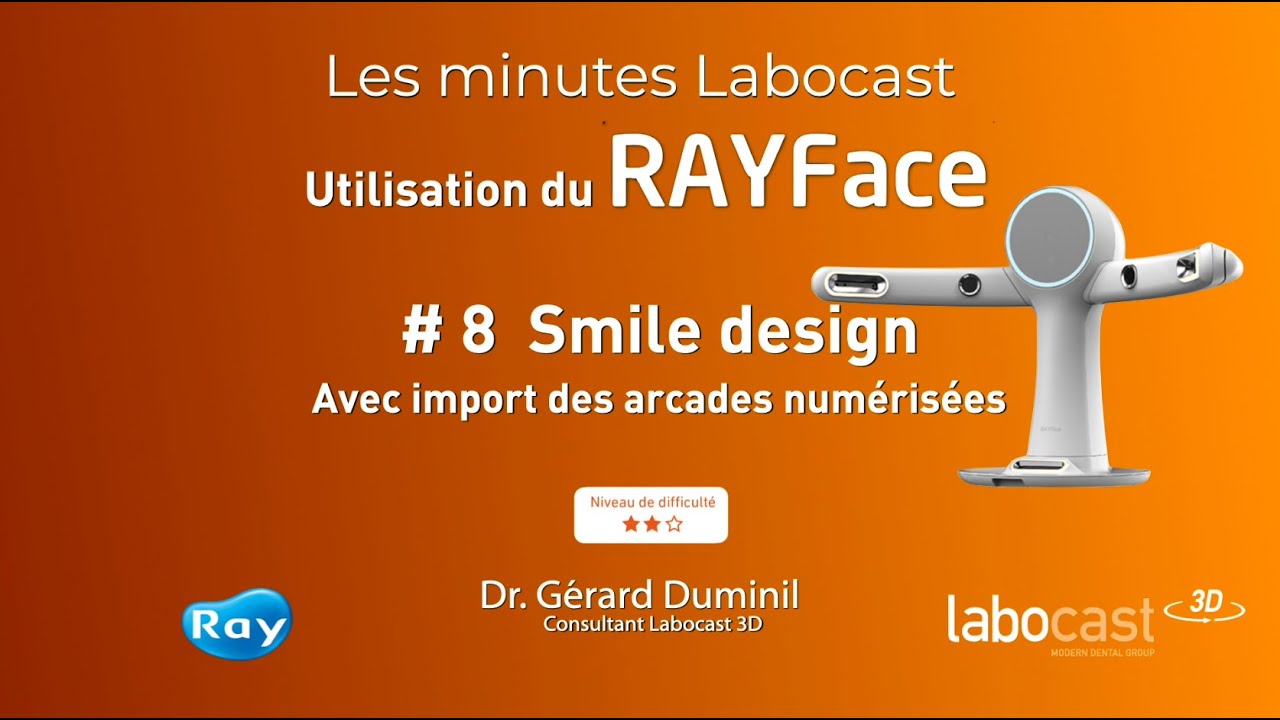 Utilisation du RAYFace : Smile design avec import des arcades numérisées